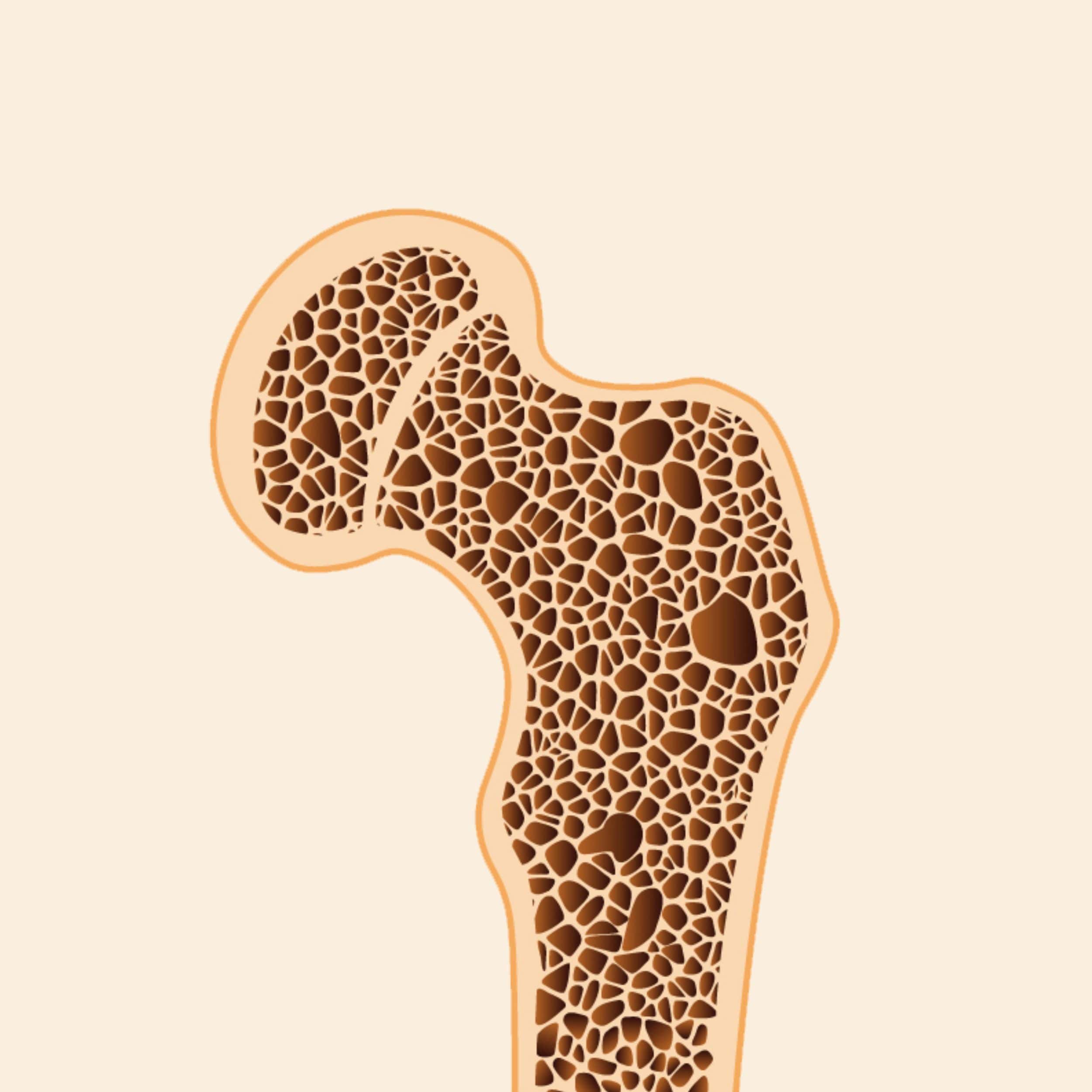 Osteoporosis Regency Medical Centre