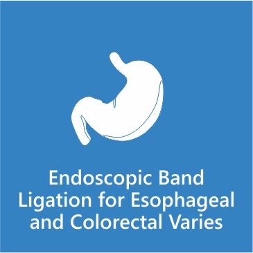 Endoscopic Band