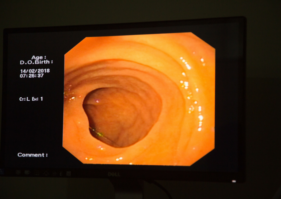 Inside look of body through endoscopy