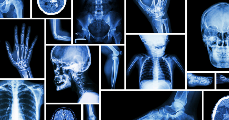 X Ray Radiation risk