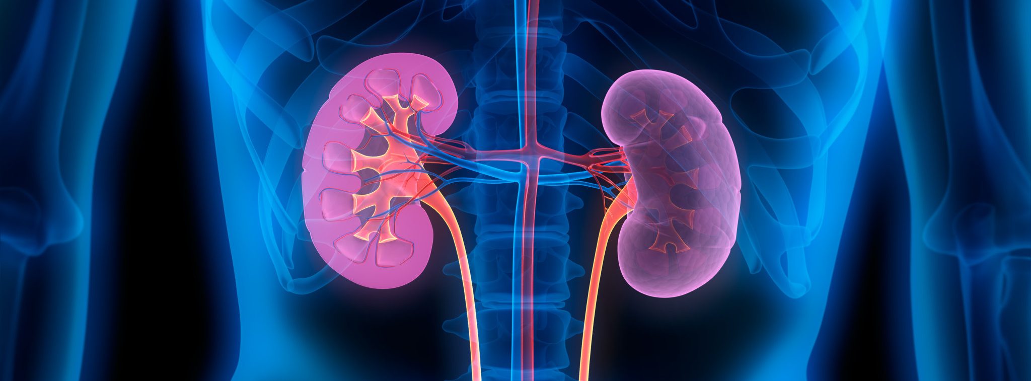 Kidney disease