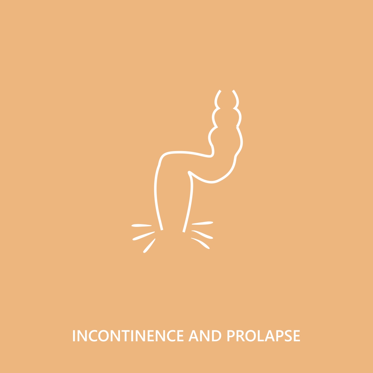 Incontinence and Prolapse Image