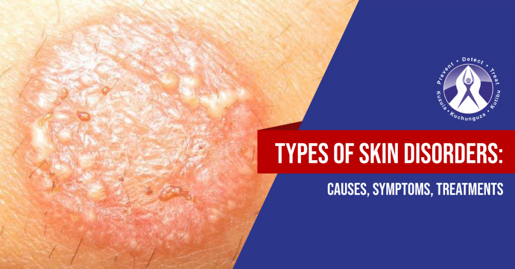 Skin Disorders Eczema, Scabies, Tinea Corporis Regency Medical Centre