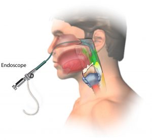 endoscopic-biopsy