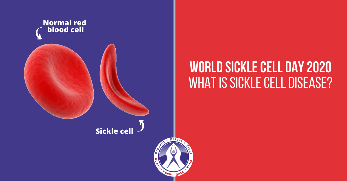world sickle cell day 2020