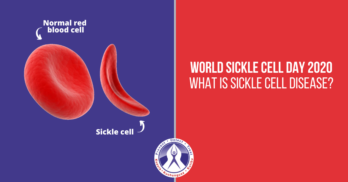 Sickle Cell Disease and ICU