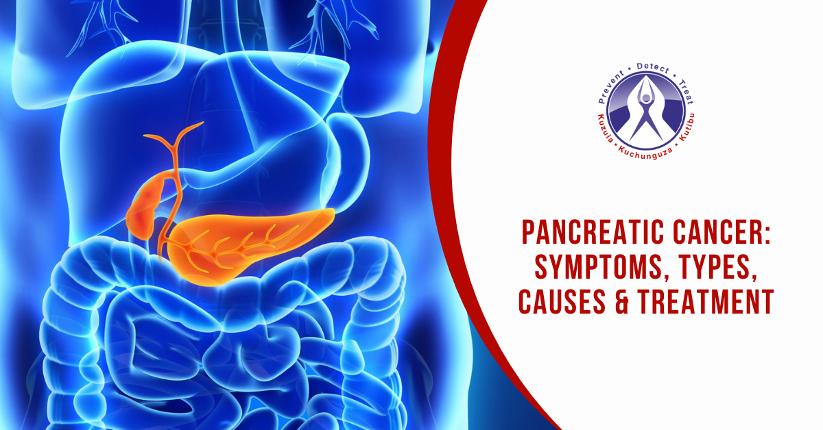 cancer pancreatic blog