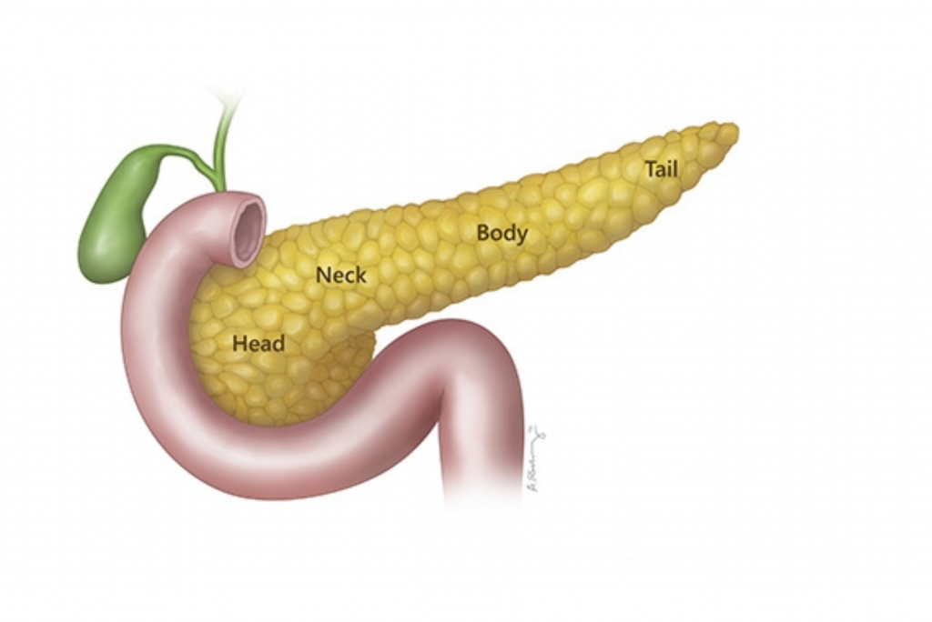 what is pancreatic cancer