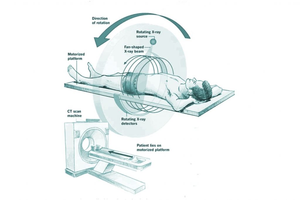 CT Scans how does it work