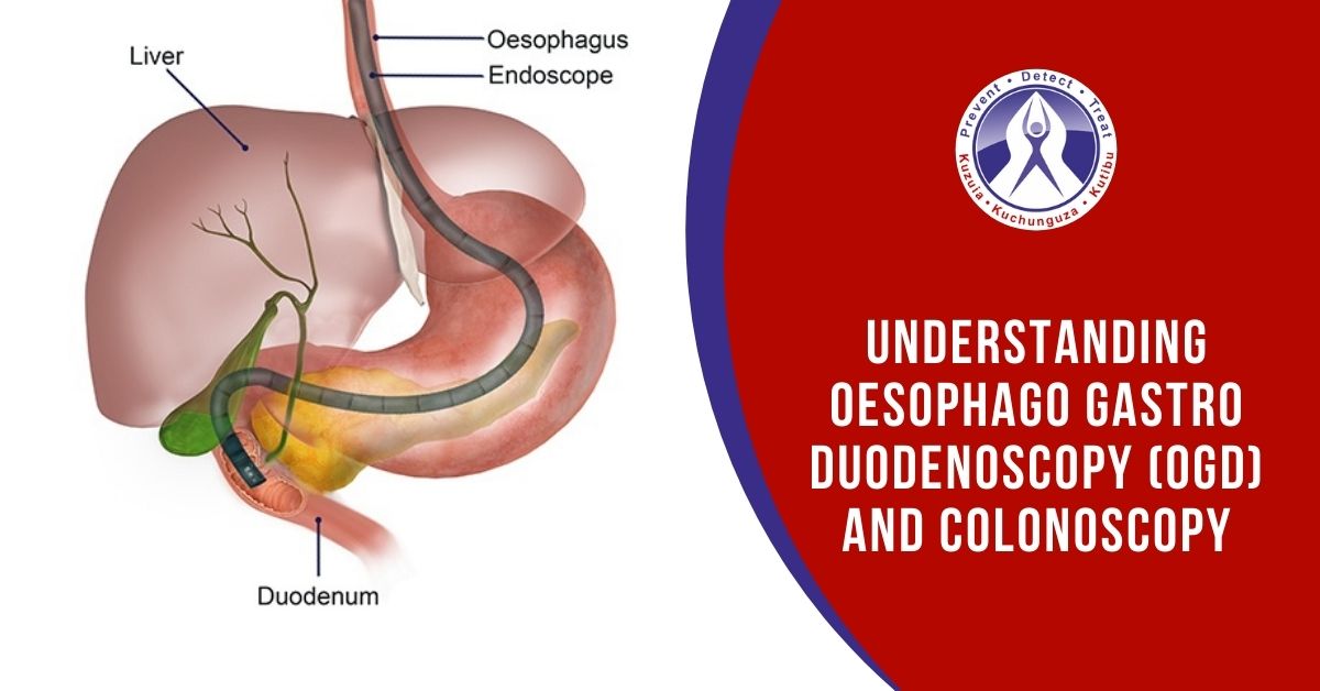 Oesophago Gastro Duodenoscopy OGD
