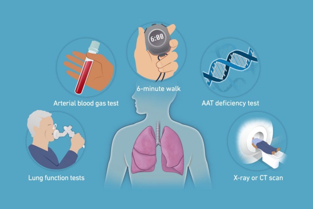 Diagnosis of Asthma in children