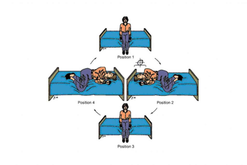 Brandt-Daroff exercise for Vertigo