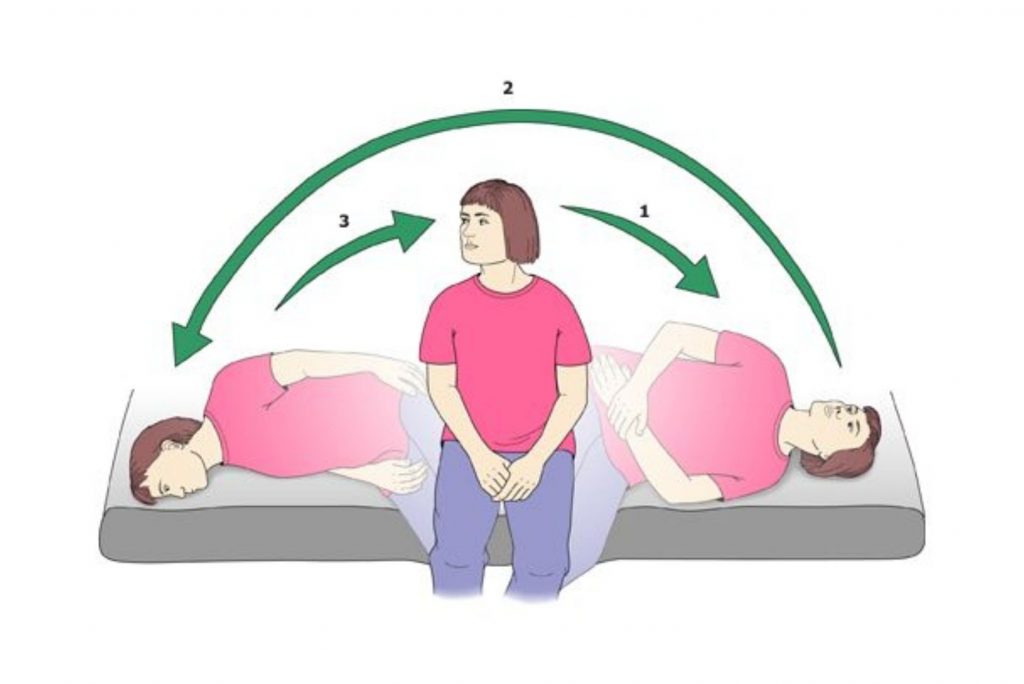 Semont maneuver exercise for Vertigo