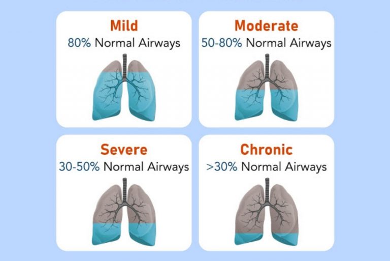 AN INFORMATION GUIDE TO ‘CHRONIC OBSTRUCTIVE PULMONARY DISEASE