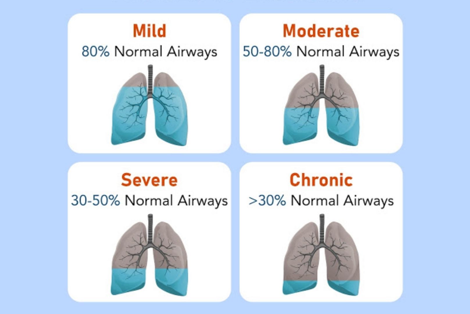 Stages Of COPD Death