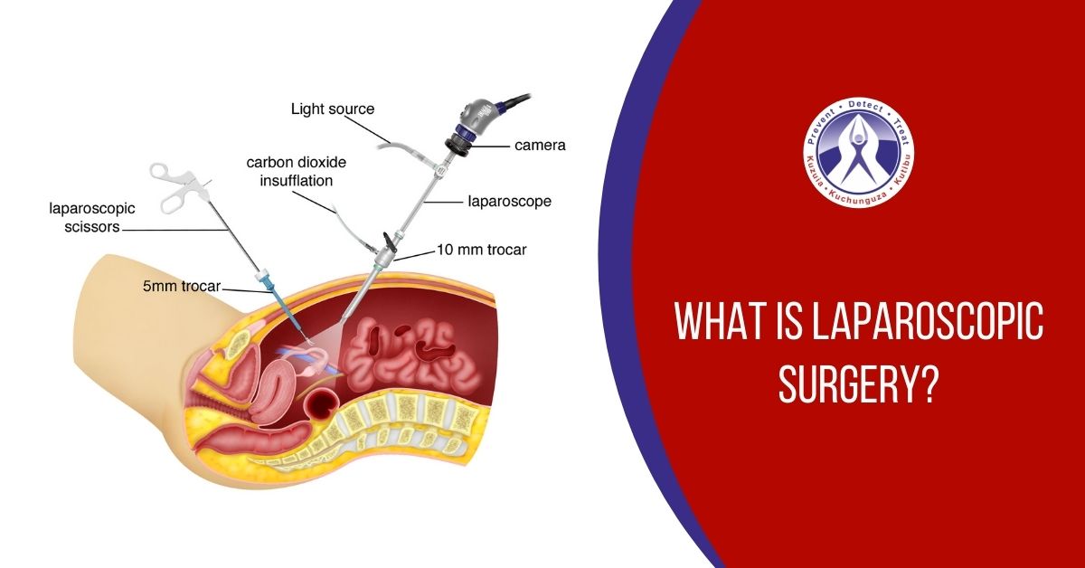 Laparoscopic Surgery