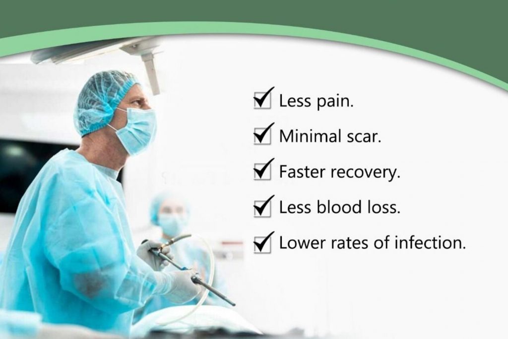 benefits of Laparoscopic Surgery