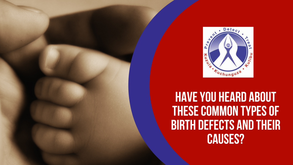 Common Types of Birth Defects and Their Causes RMC Tanzania